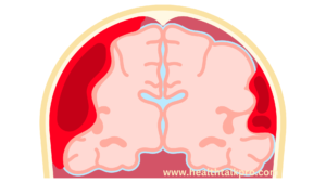 a diagram of a brain