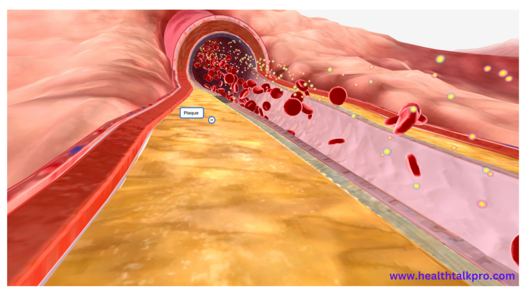 a screenshot of a computer screen showing a blood flow